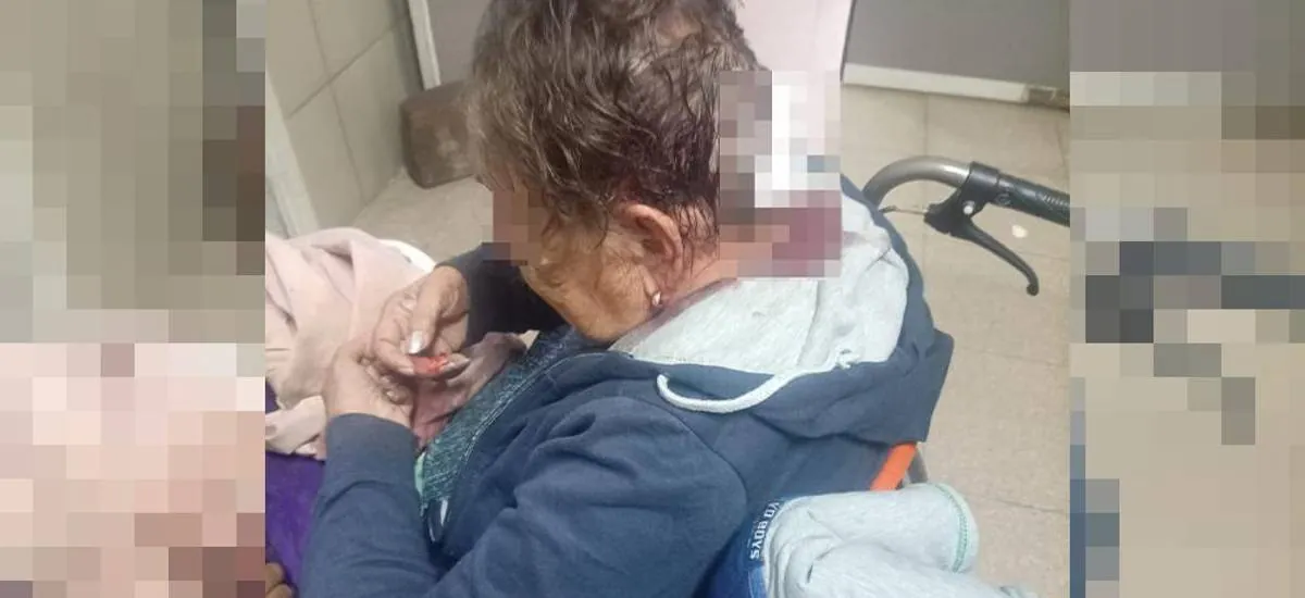Delincuentes golpean en la cabeza con un ladrillo a una adulta mayor para robarle sus pertenencias