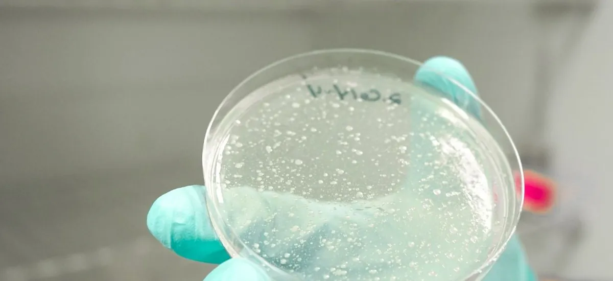 EEUU registra casi 2.000 casos de Cyclospora, un parásito que causa diarrea "explosiva"