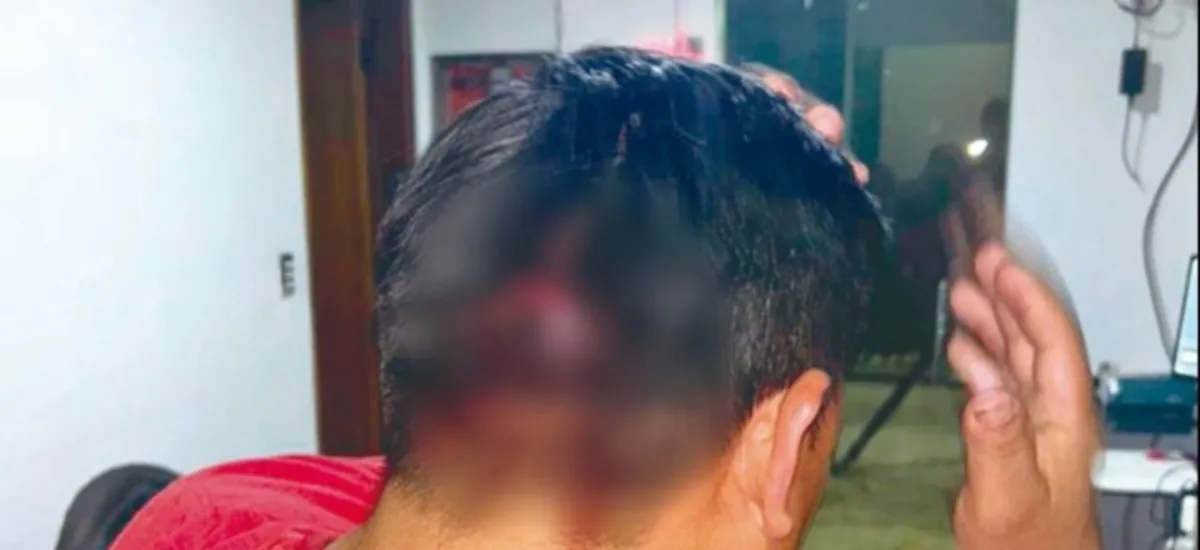 Guardia golpeado: Me decía que las joyas valían más que mi vida
